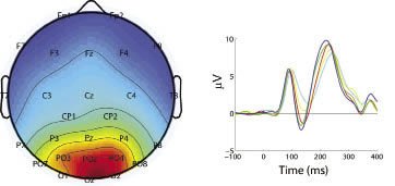 Image of EEG